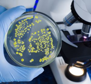 A scientist's gloved hand holding a petri dish showing microbial cultures in a food safety laboratory