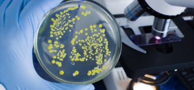 A scientist's gloved hand holding a petri dish showing microbial cultures in a food safety laboratory