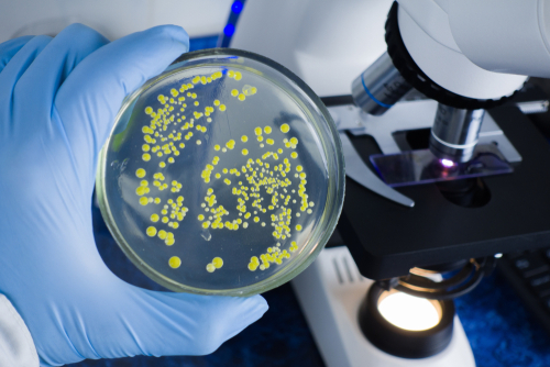 A scientist's gloved hand holding a petri dish showing microbial cultures in a food safety laboratory